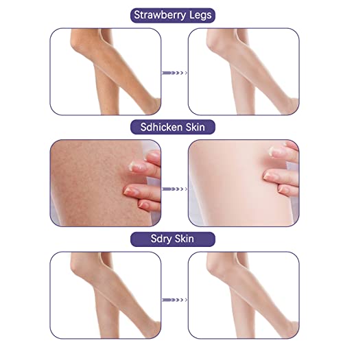 Lupure KP Bump Eraser Body Scrub, Strawberry Legs Treatment, exfoliant corporal exfoliant, exfoliant corporal pentru femei